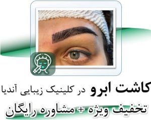 کاشت ابرو